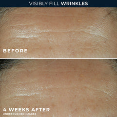 RETINOL CORREXION® Deep Wrinkle Filler